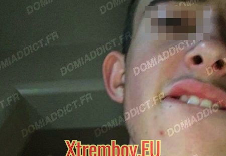 Anulingueur pour homme et femme