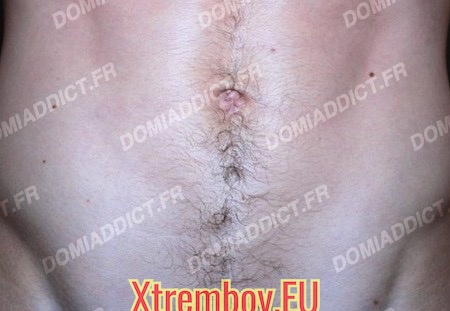 Passif bbk cherche son maître fisteur